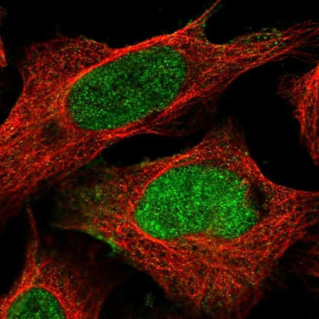 FAM13B Antibody in Immunocytochemistry (ICC/IF)