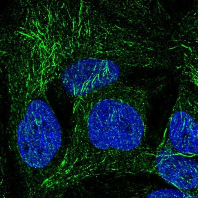 SPRY2 Antibody in Immunocytochemistry (ICC/IF)
