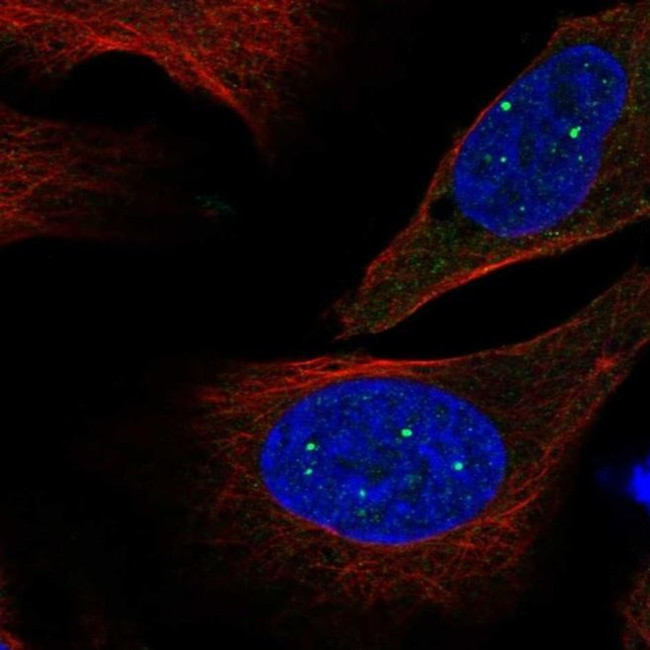 EVI5L Antibody in Immunocytochemistry (ICC/IF)