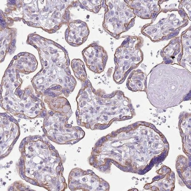 RBP3 Antibody in Immunohistochemistry (IHC)