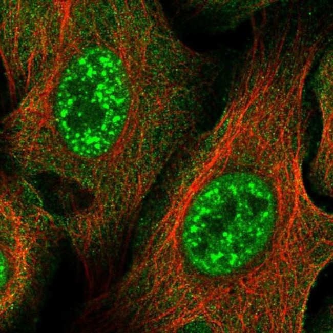 ZNF337 Antibody in Immunocytochemistry (ICC/IF)