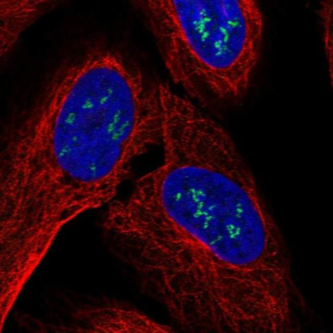 ZNF385B Antibody in Immunocytochemistry (ICC/IF)