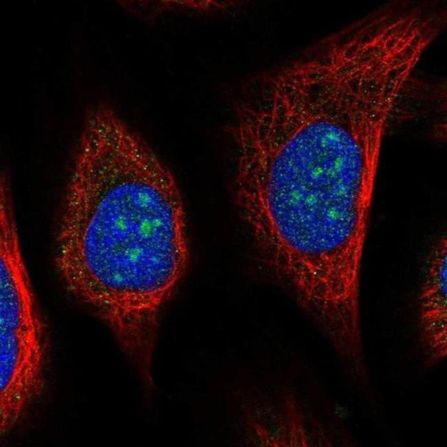 URB2 Antibody in Immunocytochemistry (ICC/IF)