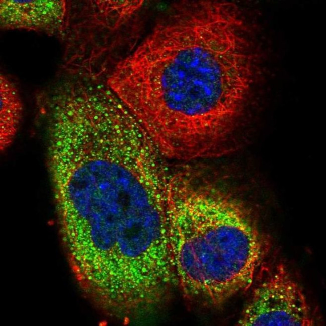 TRIM73 Antibody in Immunocytochemistry (ICC/IF)