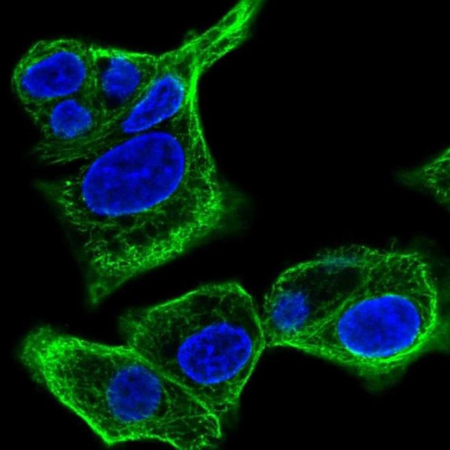 SPTLC3 Antibody in Immunocytochemistry (ICC/IF)
