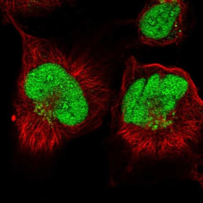 ANR49 Antibody in Immunocytochemistry (ICC/IF)