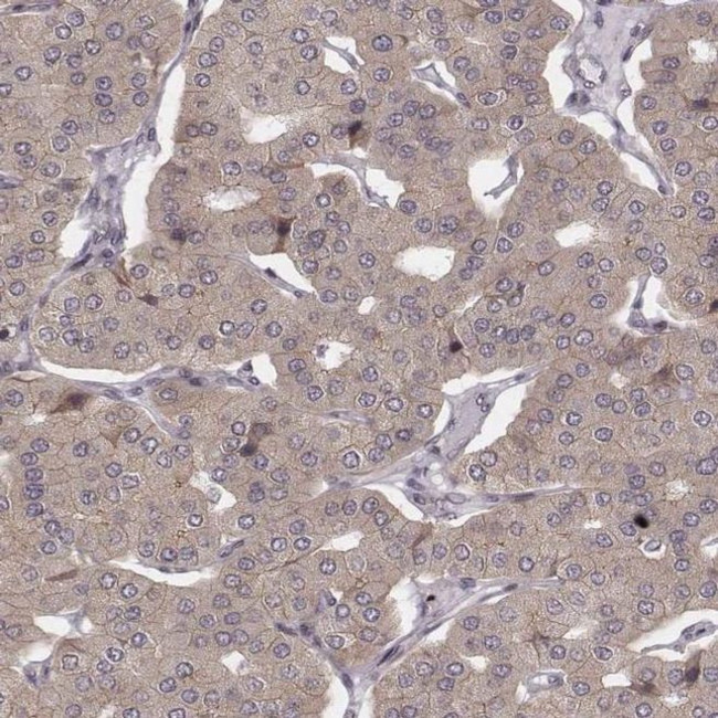 WDR59 Antibody in Immunohistochemistry (IHC)