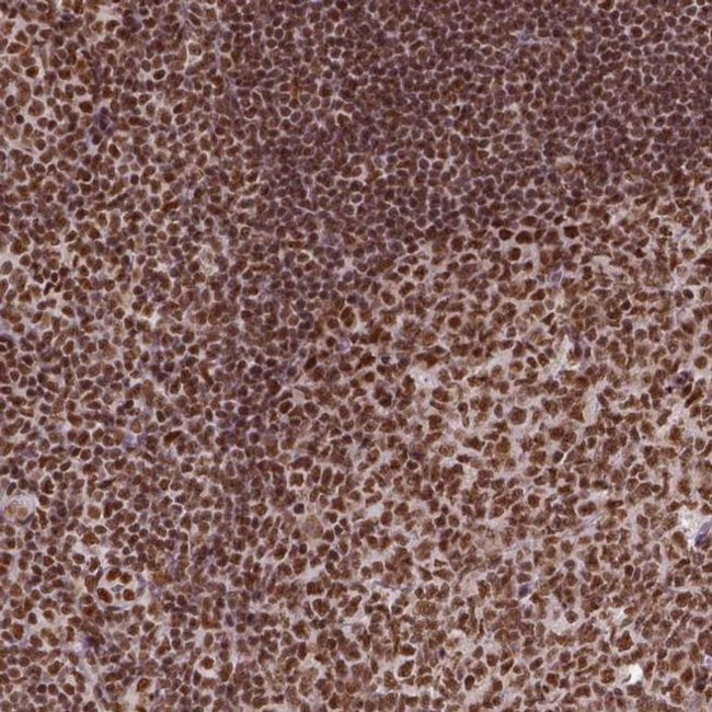 CCAR1 Antibody in Immunohistochemistry (IHC)