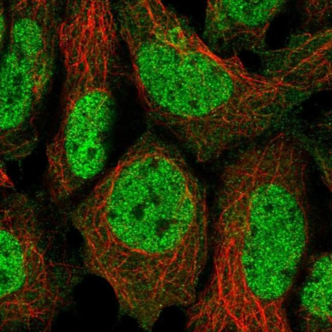 FAM219B Antibody in Immunocytochemistry (ICC/IF)