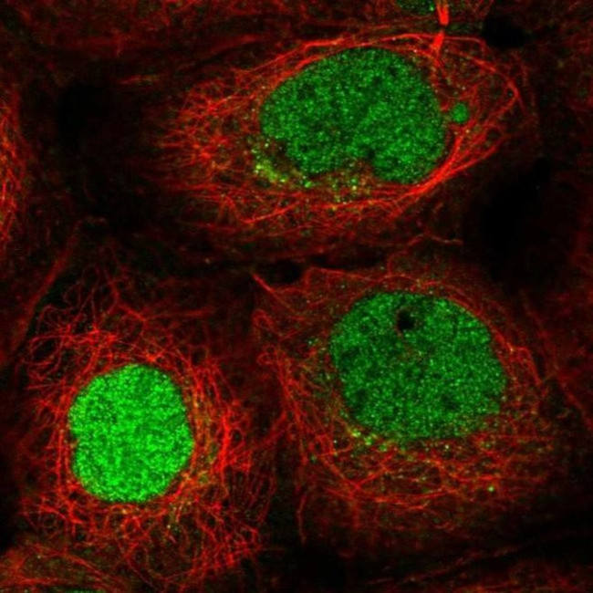 ITCH Antibody in Immunocytochemistry (ICC/IF)