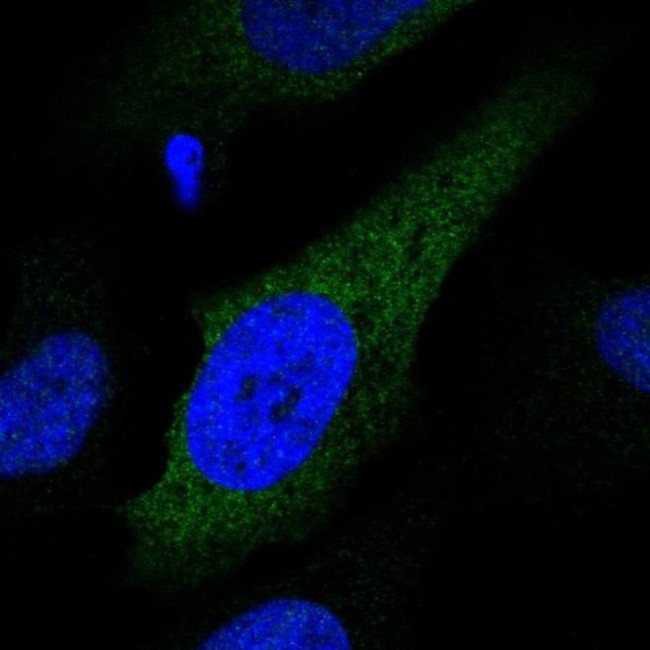 CYP2S1 Antibody in Immunocytochemistry (ICC/IF)
