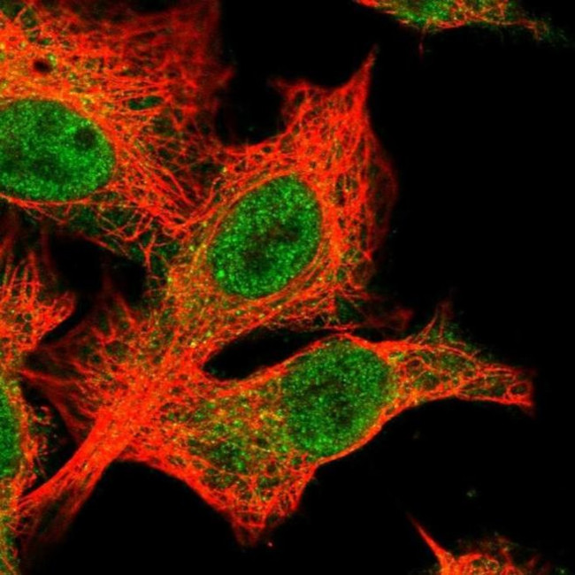BTBD12 Antibody in Immunocytochemistry (ICC/IF)
