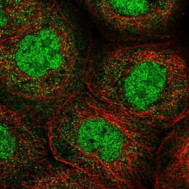 ANKRD11 Antibody in Immunocytochemistry (ICC/IF)