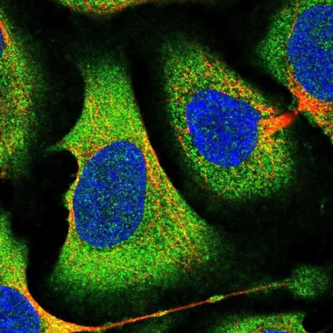 eIF2b alpha Antibody in Immunocytochemistry (ICC/IF)