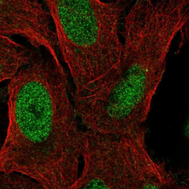 ZNF296 Antibody in Immunocytochemistry (ICC/IF)