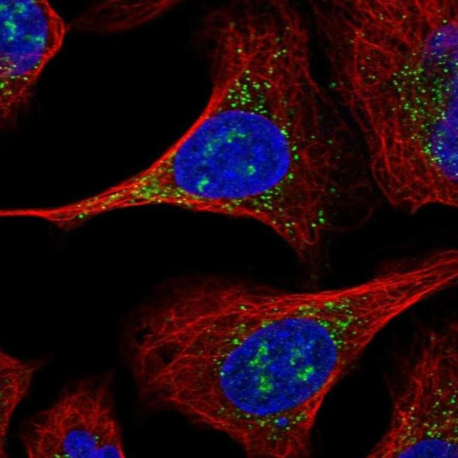 ERGIC2 Antibody in Immunocytochemistry (ICC/IF)