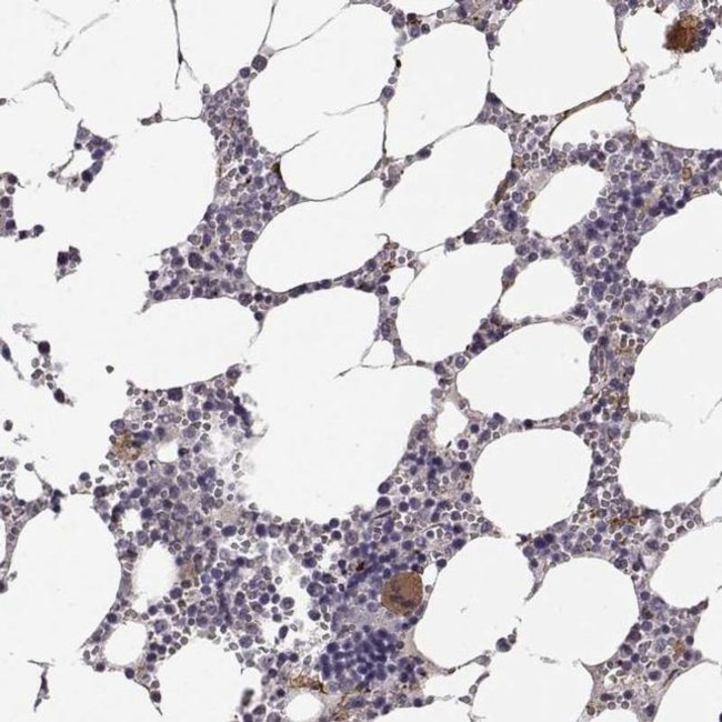 KRT81 Antibody in Immunohistochemistry (IHC)
