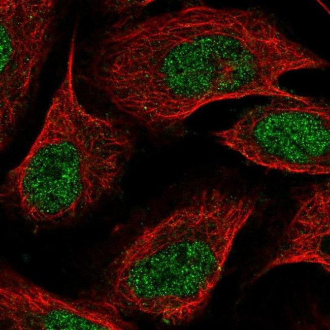 ZDBF2 Antibody in Immunocytochemistry (ICC/IF)