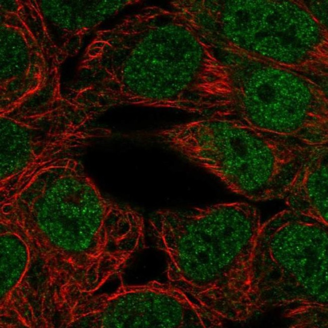 PPARGC1B Antibody in Immunocytochemistry (ICC/IF)