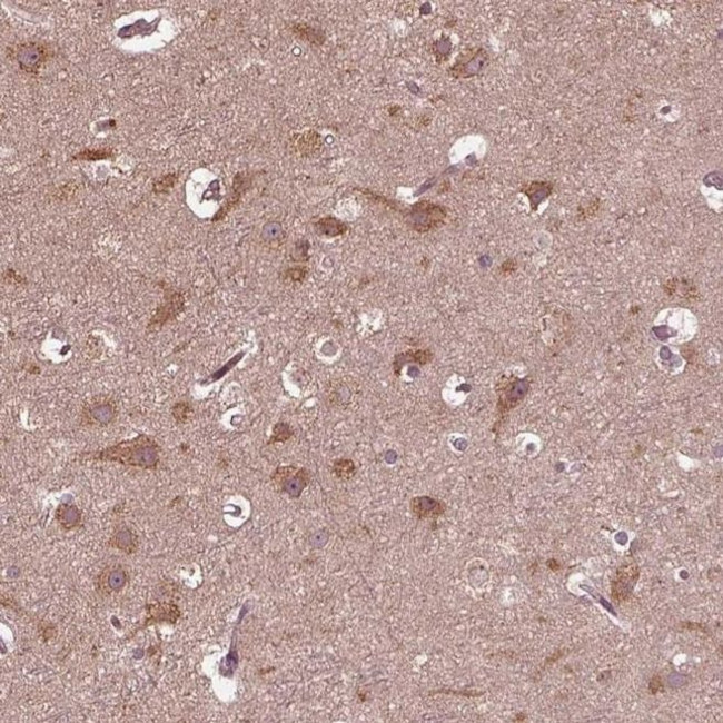 ZNF292 Antibody in Immunohistochemistry (IHC)