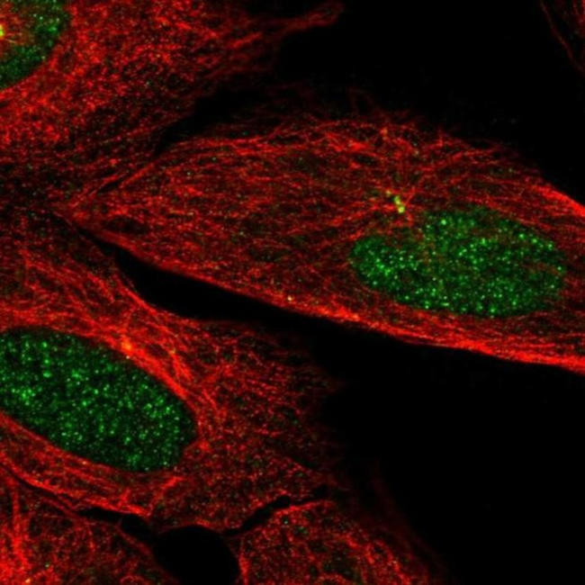 CAMK2N2 Antibody in Immunocytochemistry (ICC/IF)