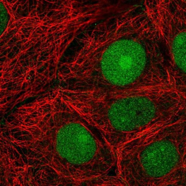 CERCAM Antibody in Immunocytochemistry (ICC/IF)