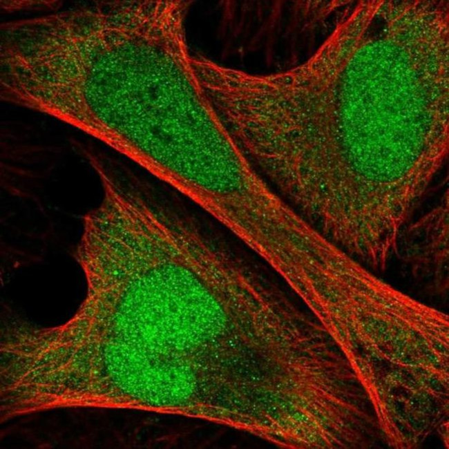 ANKRD36C Antibody in Immunocytochemistry (ICC/IF)