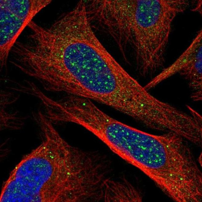 CHIC1 Antibody in Immunocytochemistry (ICC/IF)