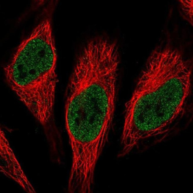 RNPC3 Antibody in Immunocytochemistry (ICC/IF)