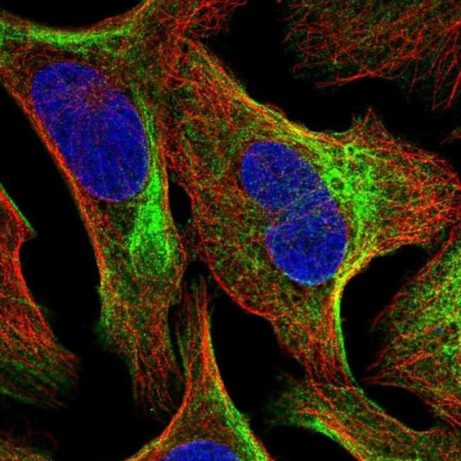 TMEM81 Antibody in Immunocytochemistry (ICC/IF)