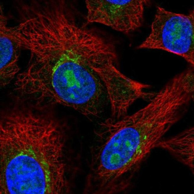 PDGFRL Antibody in Immunocytochemistry (ICC/IF)