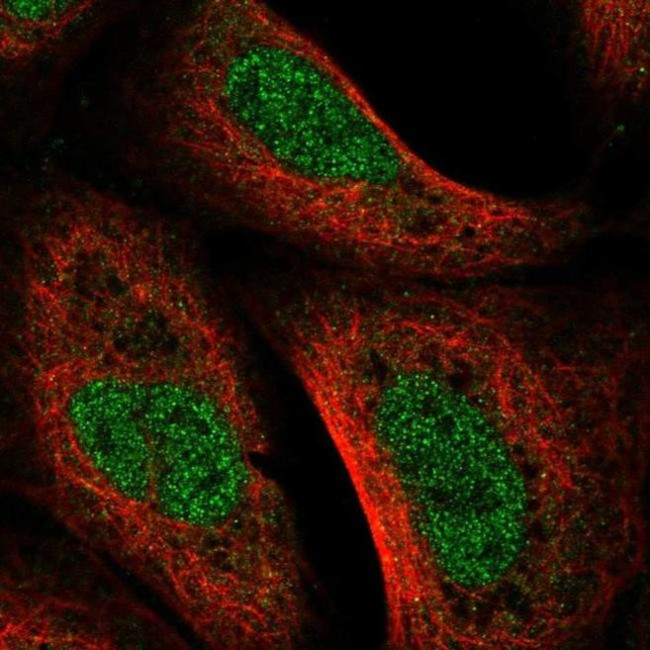 KIAA1530 Antibody in Immunocytochemistry (ICC/IF)