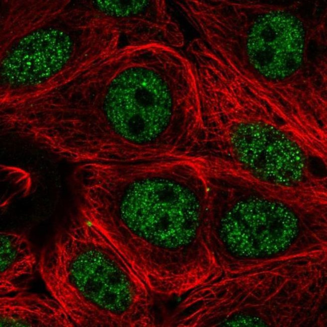 PCNX Antibody in Immunocytochemistry (ICC/IF)