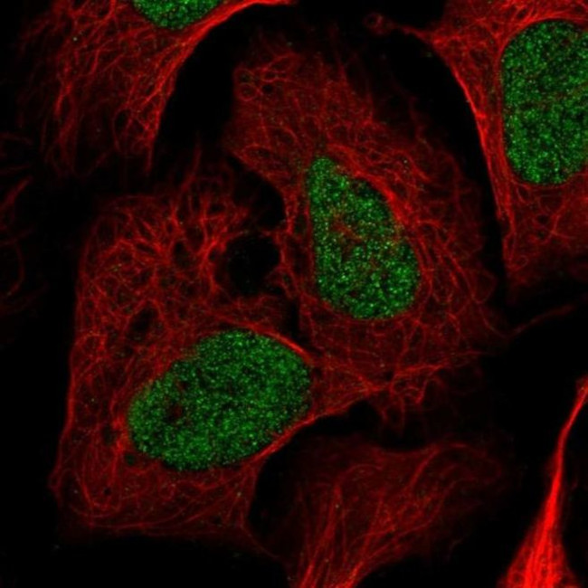 Nardilysin Antibody in Immunocytochemistry (ICC/IF)