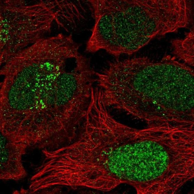 ESCO2 Antibody in Immunocytochemistry (ICC/IF)