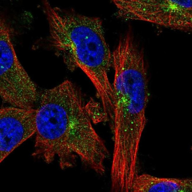 EVI5 Antibody in Immunocytochemistry (ICC/IF)