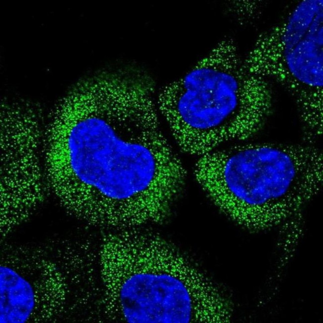 CCHCR1 Antibody in Immunocytochemistry (ICC/IF)