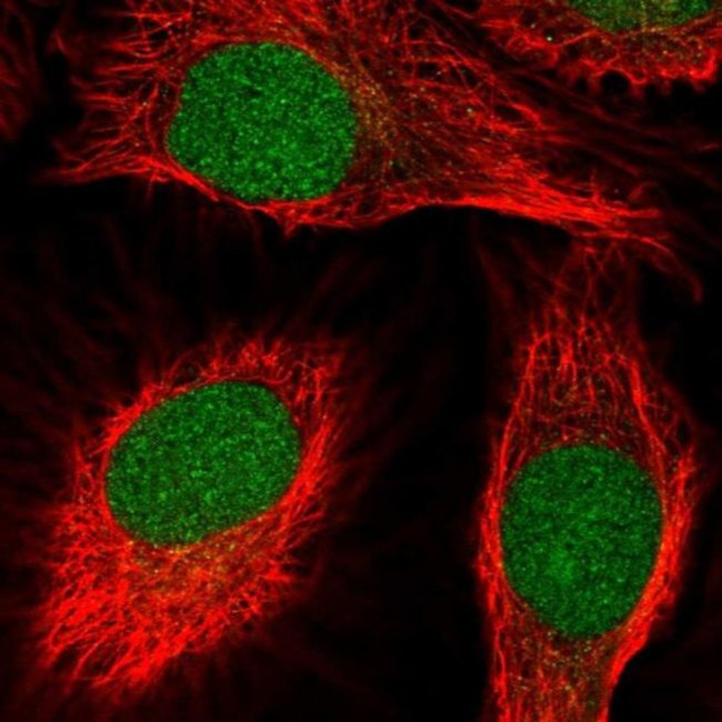 SCNM1 Antibody in Immunocytochemistry (ICC/IF)