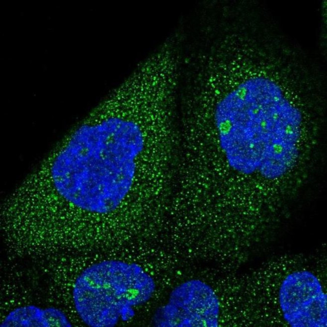SNX7 Antibody in Immunocytochemistry (ICC/IF)