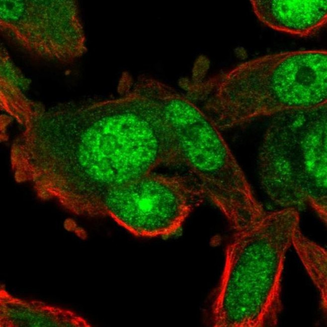 RGS12 Antibody in Immunocytochemistry (ICC/IF)