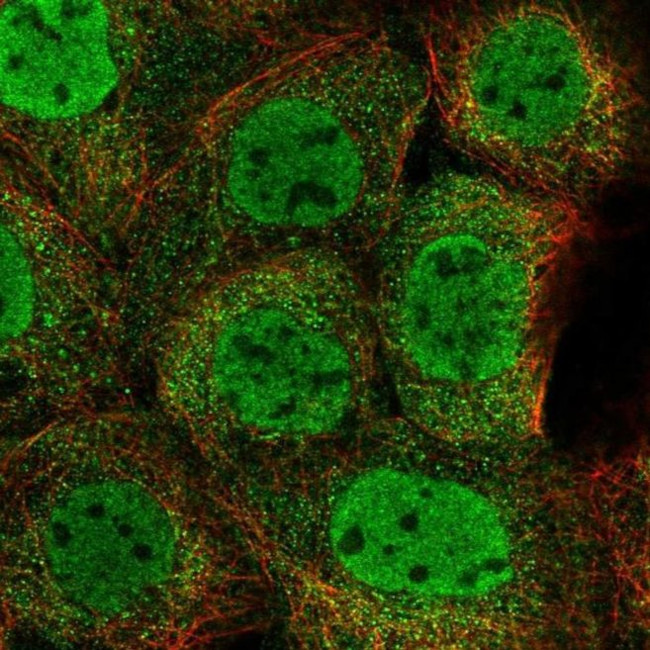 ZMYM4 Antibody in Immunocytochemistry (ICC/IF)