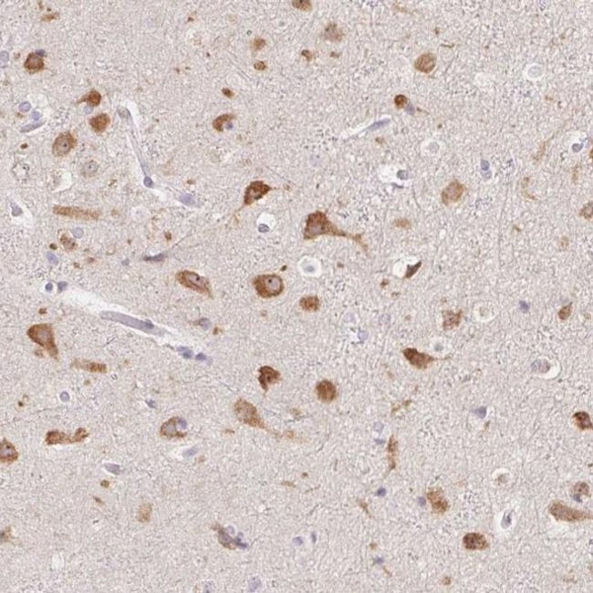 PNMAL2 Antibody in Immunohistochemistry (IHC)
