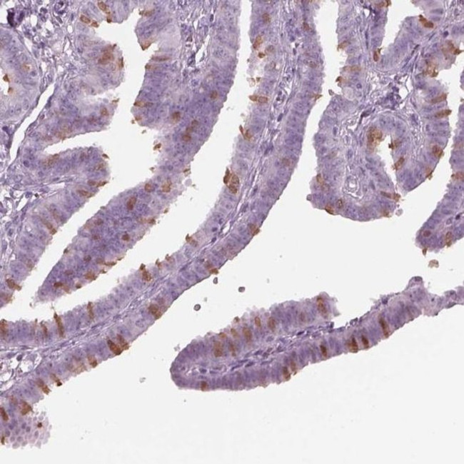 C2orf81 Antibody in Immunohistochemistry (IHC)