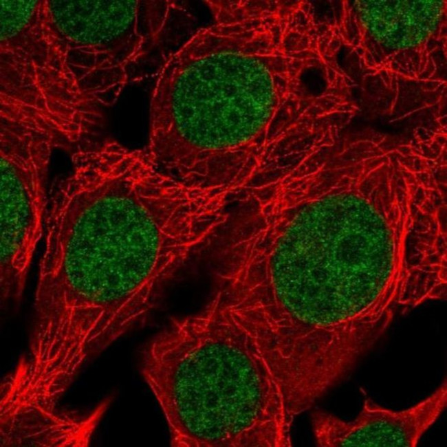 RAI1 Antibody in Immunocytochemistry (ICC/IF)