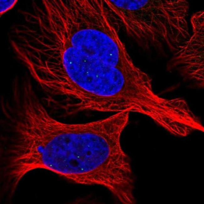 ATMIN Antibody in Immunocytochemistry (ICC/IF)