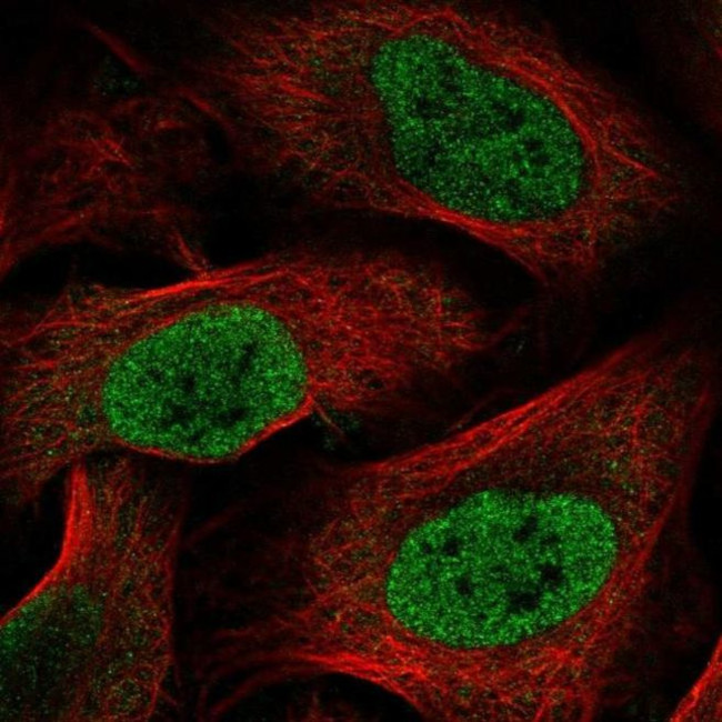 HOXC6 Antibody in Immunocytochemistry (ICC/IF)