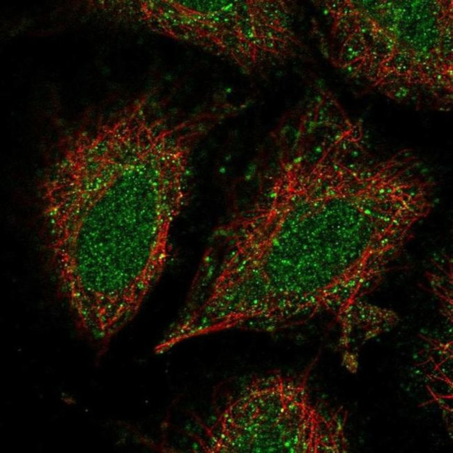 CCDC122 Antibody in Immunocytochemistry (ICC/IF)