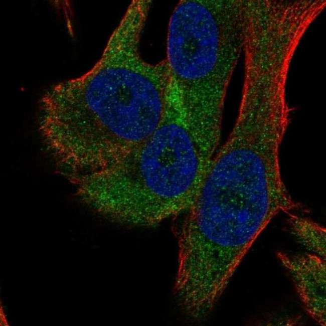 RPS18 Antibody in Immunocytochemistry (ICC/IF)