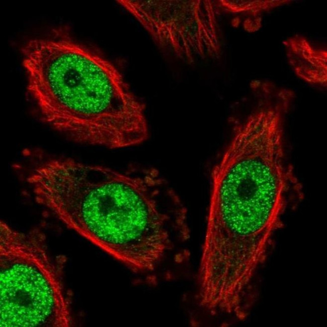NFYC Antibody in Immunocytochemistry (ICC/IF)