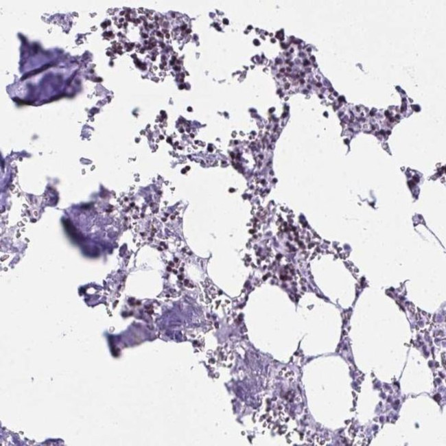 Cytokeratin 27 Antibody in Immunohistochemistry (IHC)